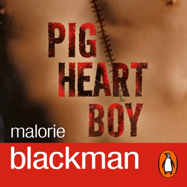 Pig-Heart Boy - Audiobook (Książka audio MP3) do pobrania w całości w archiwum ZIP