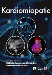 Kardiomiopatie - Elżbieta Katarzyna Biernacka - ebook