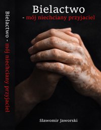 Bielactwo-mój niechciany przyjaciel - Sławomir Jaworski - ebook