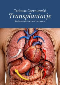 Transplantacje - Tadeusz Czerniawski - ebook