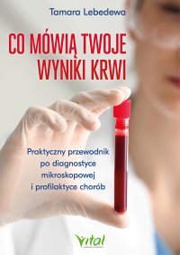 Co mówią twoje wyniki krwi - Tamara Lebedewa - ebook