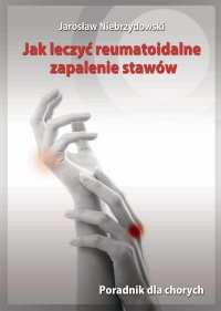 Jak leczyć reumatoidalne zapalenie stawów. Poradnik dla chorych - Jarosław Niebrzydowski - ebook