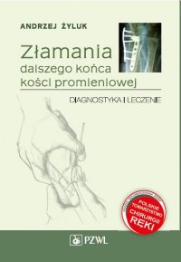 Złamania dalszego końca kości promieniowej: diagnostyka i leczenie - Andrzej Żyluk - ebook