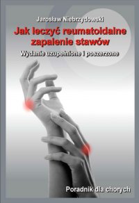 Jak leczyć reumatoidalne zapalenie stawów II - Jarosław Niebrzydowski - ebook