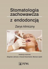 Stomatologia zachowawcza z endodoncją. Zarys kliniczny - Zbigniew Jańczuk - ebook