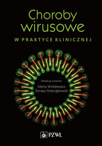 Choroby wirusowe w praktyce klinicznej - red. Marta Wróblewska - ebook