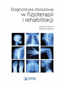 Diagnostyka obrazowa w fizjoterapii i rehabilitacji - red. Dominik Sieroń - ebook