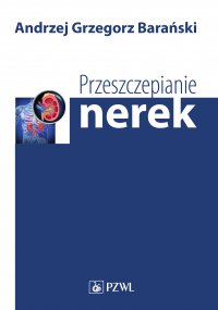 Przeszczepianie nerek - Andrzej Grzegorz Barański - ebook