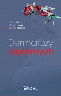 Dermatozy ciężarnych - Adam Reich - ebook