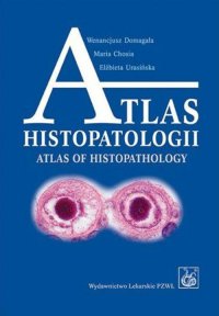 Atlas histopatologii.Tajemniczy świat chorych komórek człowieka - Wenancjusz Domagała - ebook