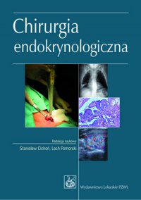 Chirurgia endokrynologiczna - Lech Pomorski - ebook