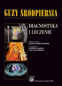 Guzy śródpiersia. Diagnostyka i leczenie - Jacek Gawrychowski - ebook