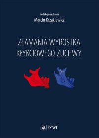 Złamania wyrostka kłykciowego żuchwy - Marcin Kozakiewicz - ebook