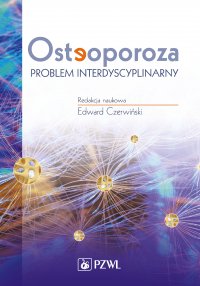 Osteoporoza. Problem interdyscyplinarny - Edawrd Czerwiński - ebook