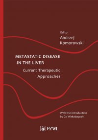 Metastatic Disease in the Liver - Current Therapeutic Approaches - Andrzej Komorowski - ebook