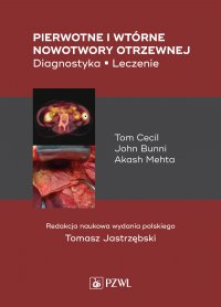Pierwotne i wtórne nowotwory otrzewnej - Tomasz Jastrzębski - ebook
