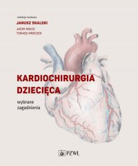 Kardiochirurgia dziecięca - Janusz Skalski - ebook