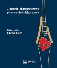Złamania okołoprotezowe po aloplastykach dużych stawów - Edward Golec - ebook