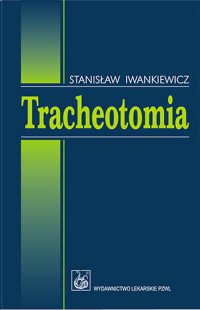 Tracheotomia - Stanisław Iwankiewicz - ebook