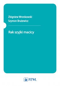 Rak szyjki macicy - Zbigniew Wronkowski - ebook