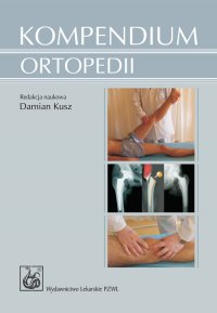Kompendium ortopedii - Damian Kusz - ebook