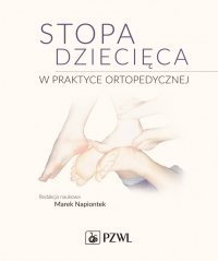 Stopa dziecięca w praktyce ortopedycznej - Marek Napiontek - ebook