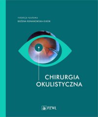 Chirurgia okulistyczna - Bożena Romanowska-Dixon - ebook