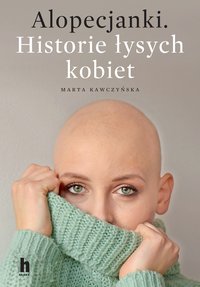 Alopecjanki - Marta Kawczyńska - ebook