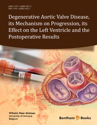 Degenerative Aortic Valve Disease, its Mechanism on Progression, its Effect on the Left Ventricle and the Postoperative Results - Wilhelm Peter Mistiaen - ebook