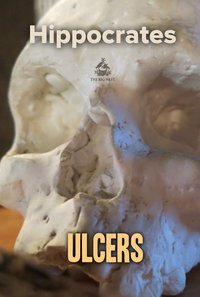 Ulcers - Hippocrates - ebook