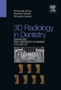 3D Radiology in Dentistry - Emanuele Ambu - ebook