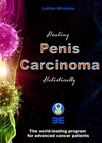 Penis carcinoma - Lothar Hirneise - ebook