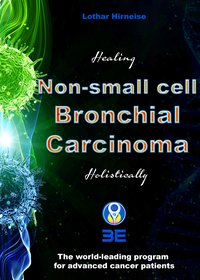 Non-small Cell Bronchial Carcinoma - Lothar Hirneise - ebook