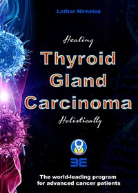 Thyroid Gland Carcinoma - Lothar Hirneise - ebook