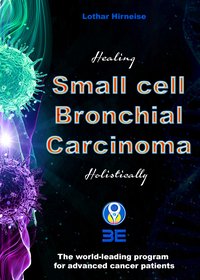 Small cell bronchial carcinoma - Lothar Hirneise - ebook