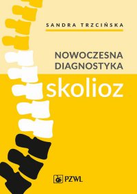 Nowoczesna diagnostyka skolioz - Sandra Trzcińska - ebook