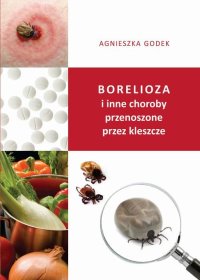 Borelioza i inne choroby przenoszone przez kleszcze - Agnieszka Godek - ebook