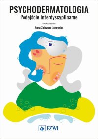 Psychodermatologia. Podejście interdyscyplinarne - Anna Zalewska-Janowska - ebook