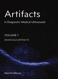 Artifacts in Diagnostic Medical Ultrasound - Martin Necas - ebook