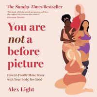 You Are Not a Before Picture - Alex Light - audiobook