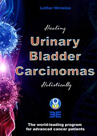 Urinary Bladder Carcinomas - Lothar Hirneise - ebook