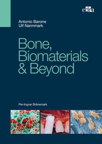 Bone, Biomaterials & Beyond - Antonio Barone - ebook