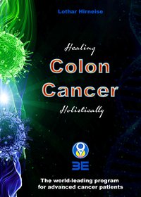Colon Cancer - Lothar Hirneise - ebook