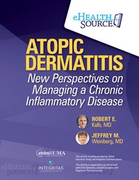 Atopic Dermatitis - Robert E. Kalb - ebook