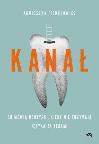 Kanał. Co mówią dentyści, kiedy nie trzymają języka za zębami - Agnieszka Fiedorowicz - ebook