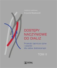 Dostępy naczyniowe do dializ. Tom 2 - Krzysztof Bojakowski - ebook