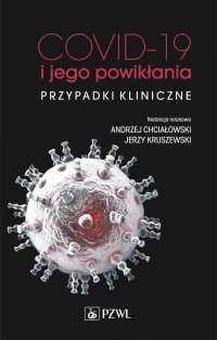 COVID-19 i jego powikłania - przypadki kliniczne - Andrzej Chciałowski - ebook