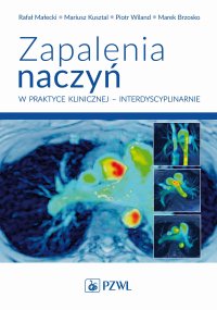 Zapalenia naczyń w praktyce klinicznej interdyscyplinarnie - Rafał Małecki - ebook