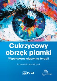 Cukrzycowy obrzęk plamki - Joanna Adamiec-Mroczek - ebook