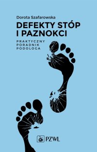 Defekty stóp i paznokci Praktyczny poradnik podologa - Dorota Szafarowska - ebook